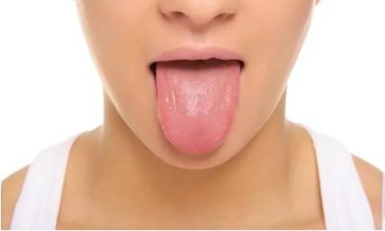 舌苔厚白的原因是什么（如何解决舌苔厚白问题）  第1张